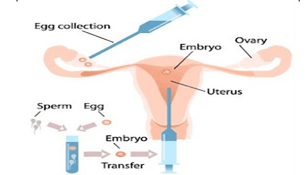 Guidelines On Egg Sperm And Embryo Donation Conceiveeasy 