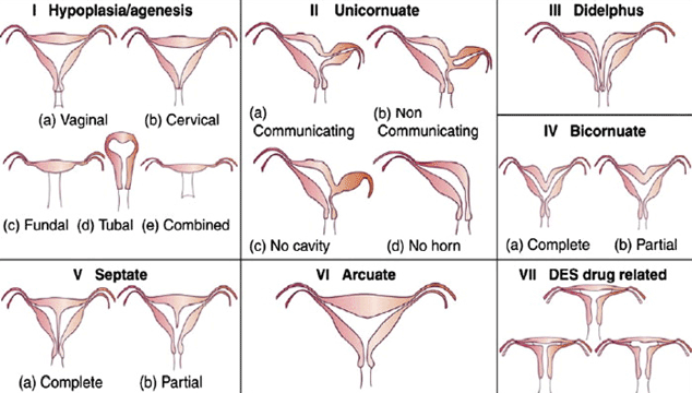 images of different vagina shapes