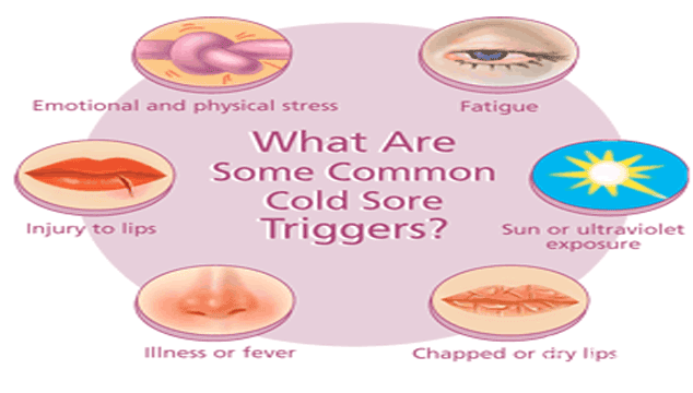 how-to-treat-children-s-cold-sores-conceiveeasy